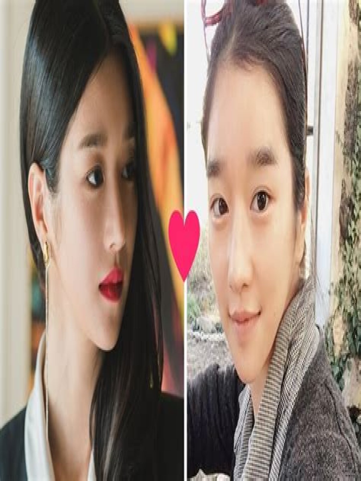 SEO Ye Ji Plastic Surgery: Unveiling The Truth Behind The Transformation